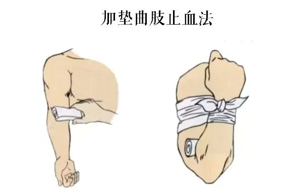 加垫曲肢止血法