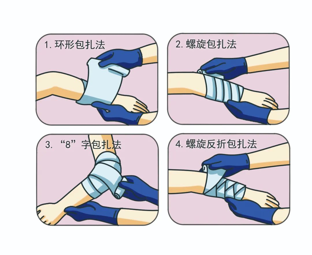 急救知识