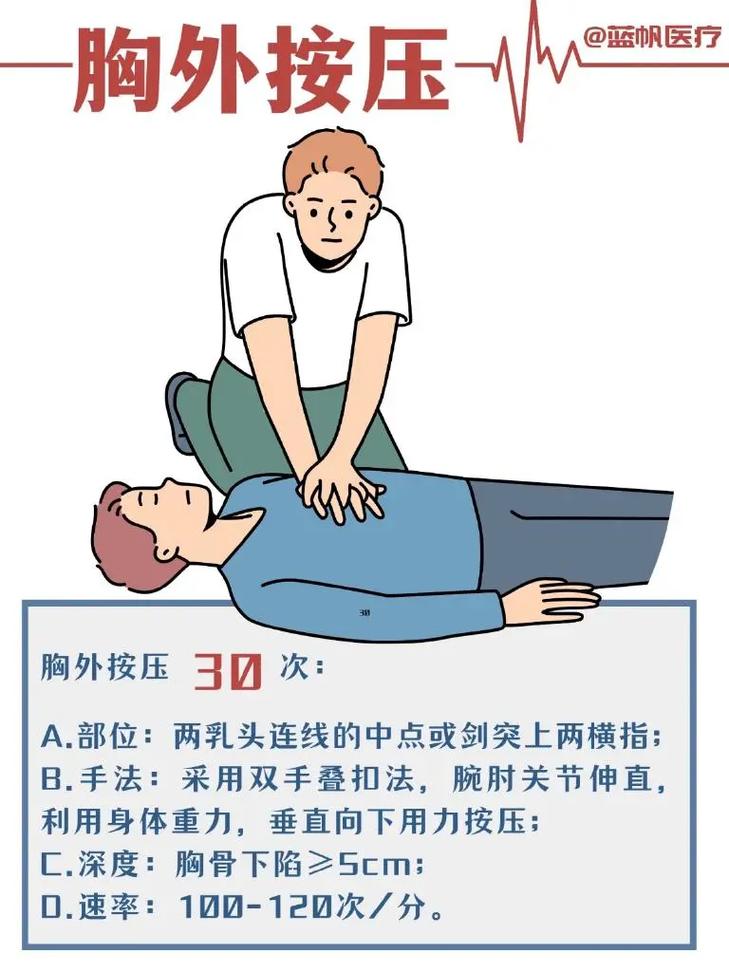 胸外按压